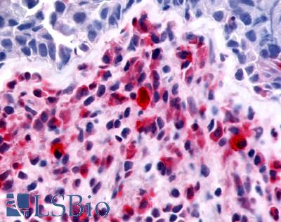MST1R / RON Antibody - Lung, Bronchitis