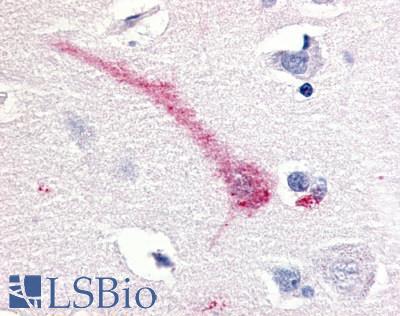 MST1R / RON Antibody - Brain Cortex Neuron