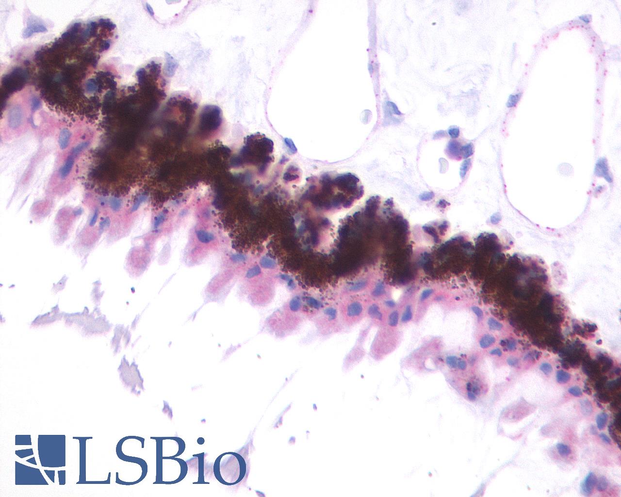 MTNR1B / MT2 Antibody - Anti-MTNR1B / MT2 antibody IHC of human eye. Immunohistochemistry of formalin-fixed, paraffin-embedded tissue after heat-induced antigen retrieval.