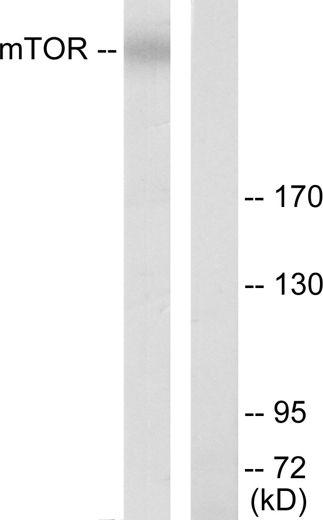 MTOR Antibody - Western blot analysis of lysates from K562 cells, using mTOR Antibody. The lane on the right is blocked with the synthesized peptide.