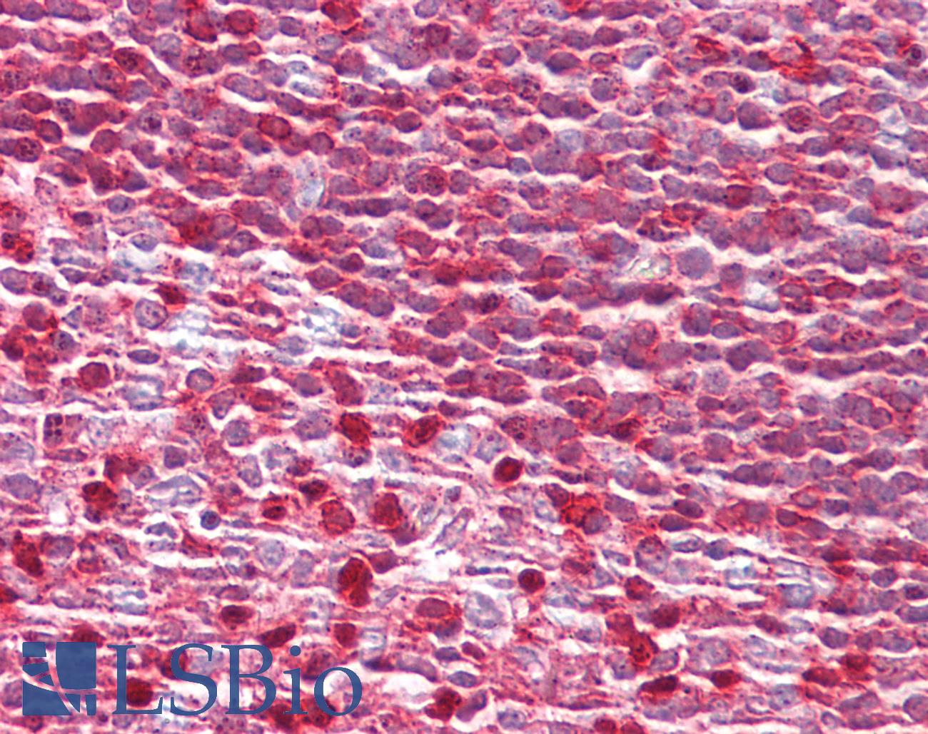 MTOR Antibody - Anti-MTOR antibody IHC of human tonsil. Immunohistochemistry of formalin-fixed, paraffin-embedded tissue after heat-induced antigen retrieval. Antibody dilution 1:100.