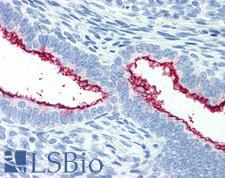MUC16 / CA125 Antibody - Anti-MUC16 / CA-125 antibody IHC of human uterus. Immunohistochemistry of formalin-fixed, paraffin-embedded tissue after heat-induced antigen retrieval. Antibody concentration 10 ug/ml.