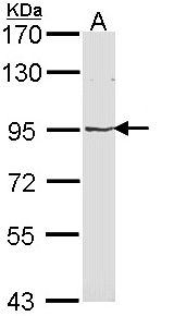 MVP / VAULT1 Antibody - Sample (30 ug of whole cell lysate). A: Molt-4 . 7.5% SDS PAGE. MVP antibody diluted at 1:1000.