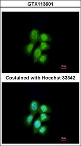 MVP / VAULT1 Antibody - Immunofluorescence of paraformaldehyde-fixed A431 using MVP/LRP antibody at 1:200 dilution.