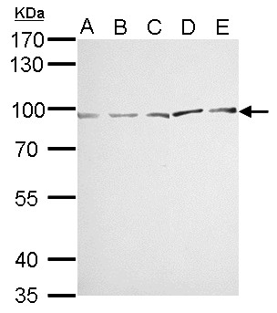 MVP / VAULT1 Antibody - MVP/LRP antibody detects MVP protein by Western blot analysis. A. 30 ug Neuro2A whole cell lysate/extract. B. 30 ug GL261 whole cell lysate/extract. C. 30 ug C8D30 whole cell lysate/extract. D. 30 ug BCL-1 whole cell lysate/extract. E. 30 ug Raw264.7 whole cell lysate/extract. 7.5 % SDS-PAGE. MVP/LRP antibody dilution:1:1000