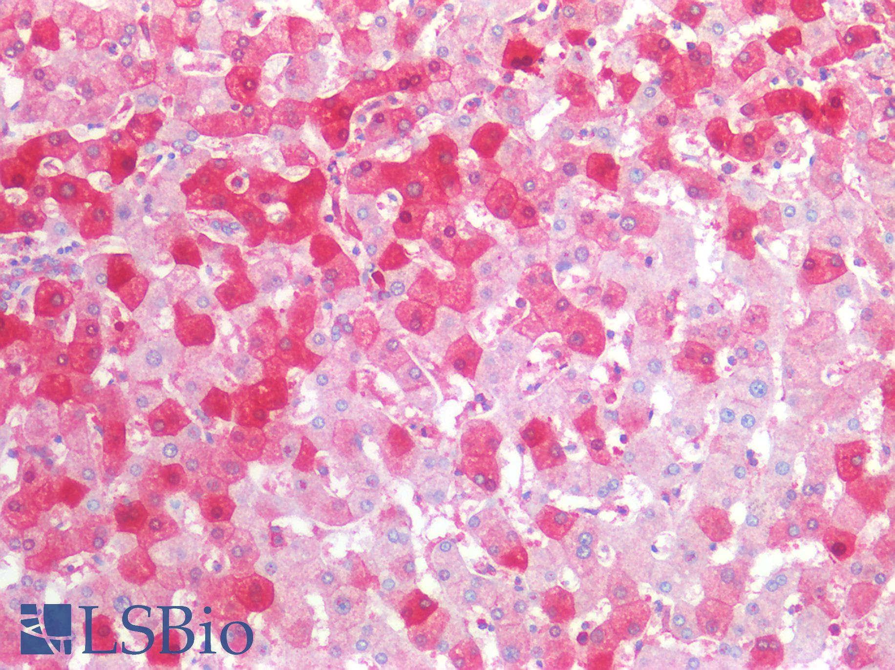 MVP / VAULT1 Antibody - Human Liver: Formalin-Fixed, Paraffin-Embedded (FFPE)