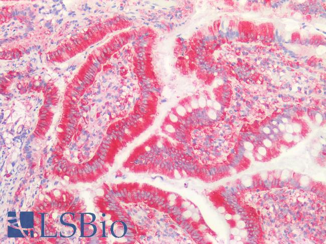 MVP / VAULT1 Antibody - Human Small Intestine: Formalin-Fixed, Paraffin-Embedded (FFPE)