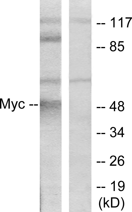 MYC / c-Myc Antibody - Western blot analysis of lysates from ovary cancer cells, using MYC Antibody. The lane on the right is blocked with the synthesized peptide.