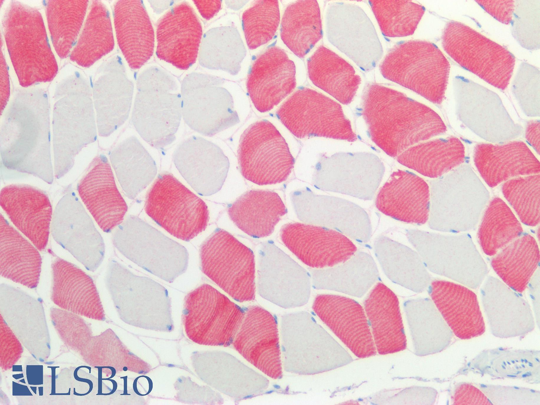 MYH1 Antibody - Human Skeletal Muscle: Formalin-Fixed, Paraffin-Embedded (FFPE)