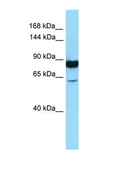 NALP3 / NLRP3 Antibody - NLRP3 antibody Western blot of Fetal Kidney lysate. Antibody concentration 1 ug/ml. This image was taken for the unconjugated form of this product. Other forms have not been tested.
