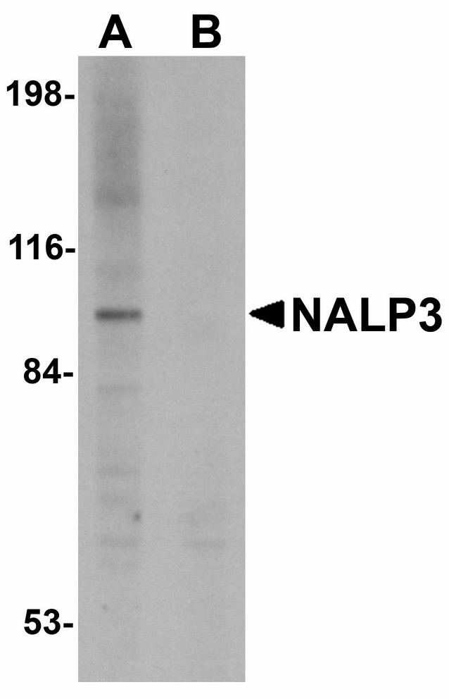 NALP3 / NLRP3 Antibody - Western blot of NLRP3 in K562 cell lysate with NLRP3 antibody at 1 ug/ml (A) in the absence and (B) in the presence of blocking peptide.
