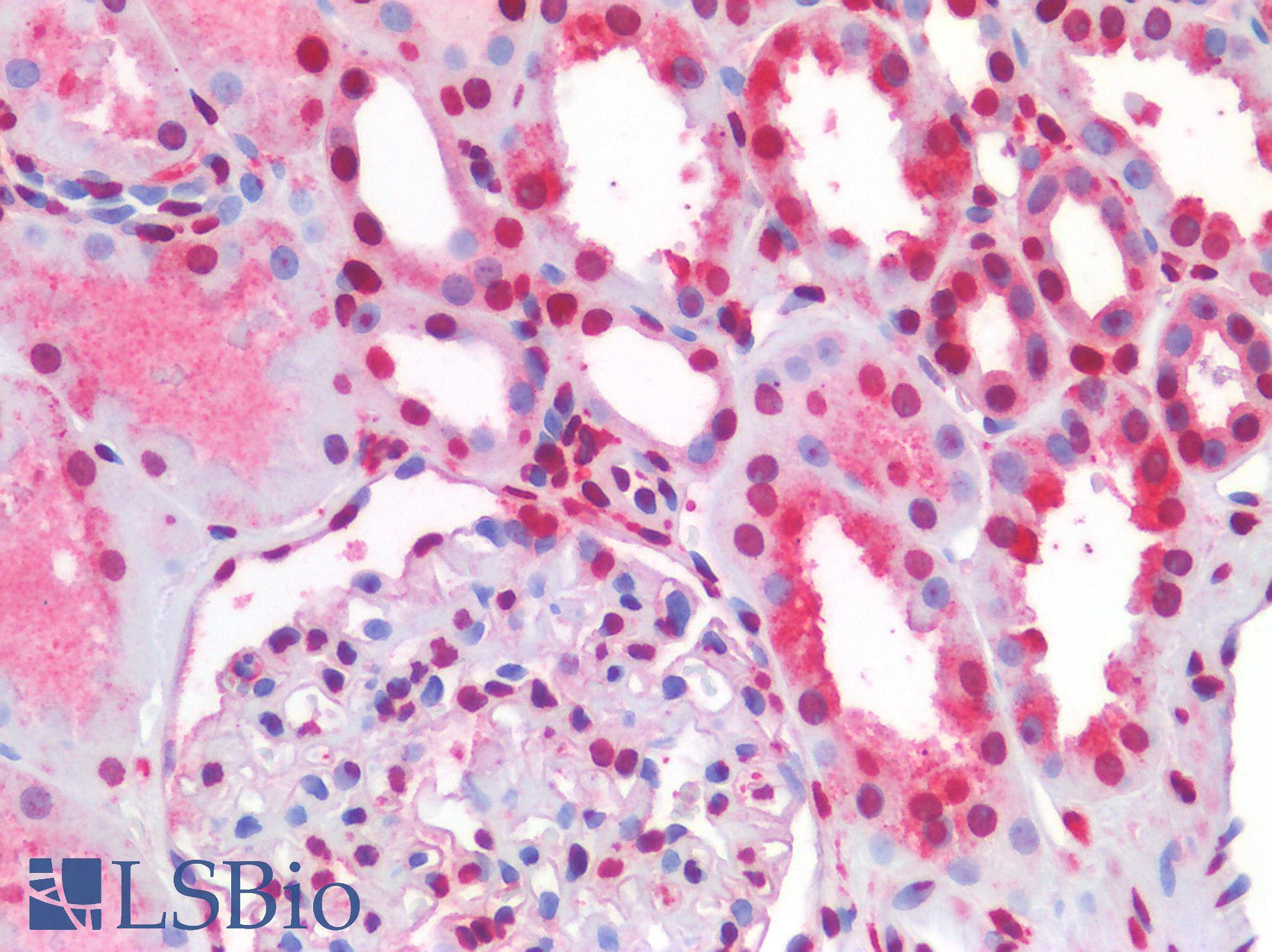 NALP3 / NLRP3 Antibody - Human Kidney: Formalin-Fixed, Paraffin-Embedded (FFPE)
