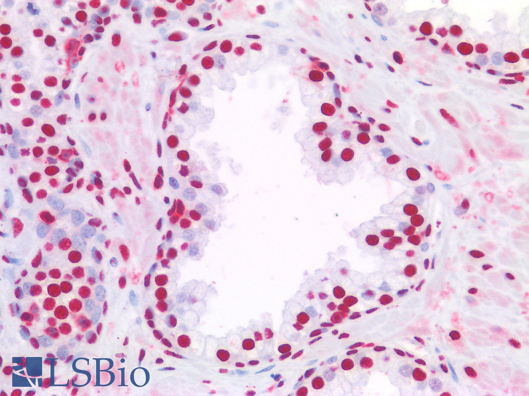 NALP3 / NLRP3 Antibody - Human Prostate: Formalin-Fixed, Paraffin-Embedded (FFPE)