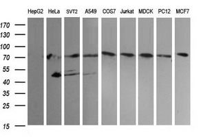 NCAM / CD56 Antibody - Western blot of extracts (35ug) from 9 different cell lines by using anti-NCAM1 monoclonal antibody (HepG2: human; HeLa: human; SVT2: mouse; A549: human; COS7: monkey; Jurkat: human; MDCK: canine; PC12: rat; MCF7: human).