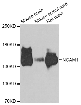 NCAM / CD56 Antibody - Western blot analysis of extracts of various cell lines.