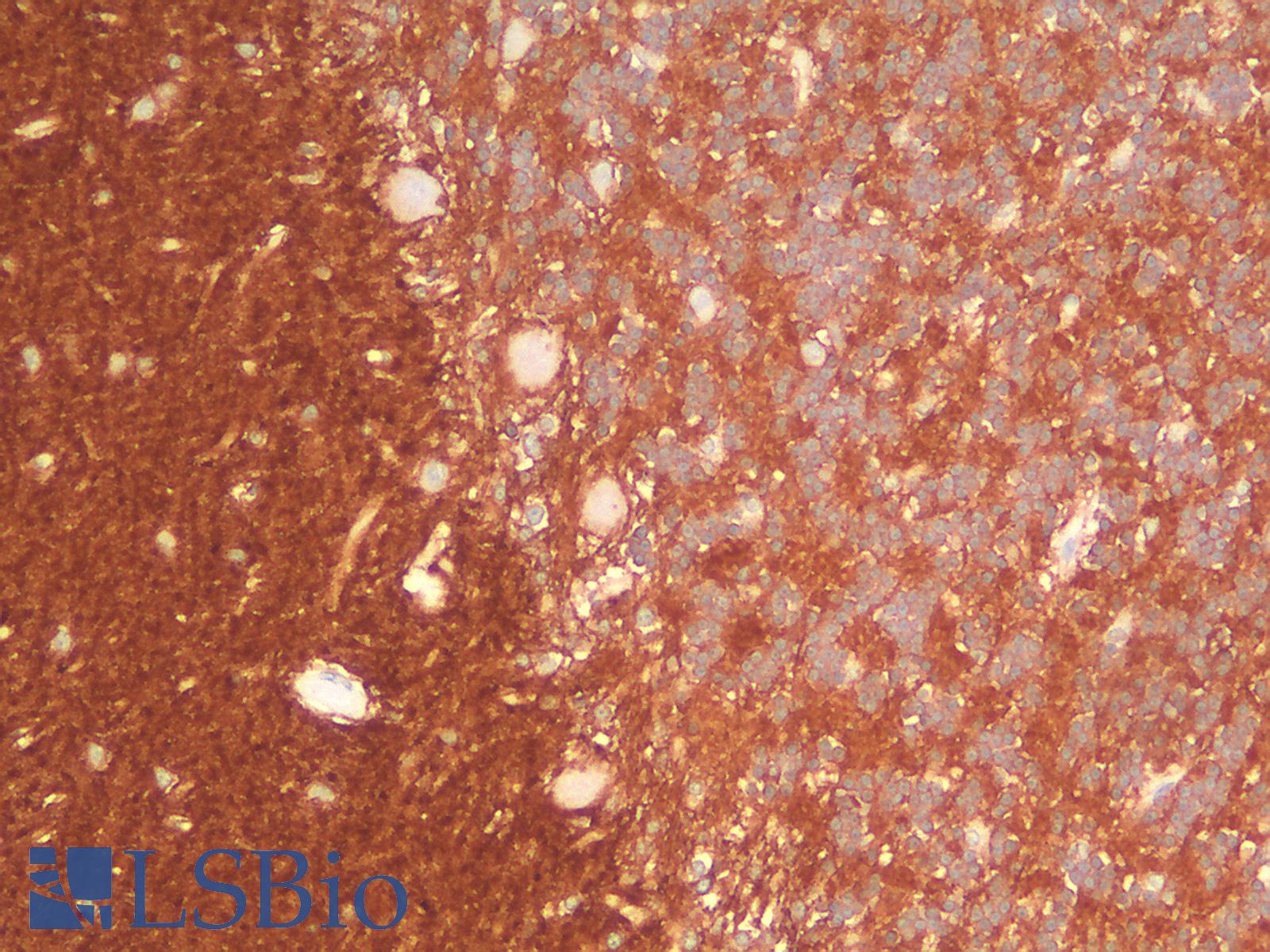 NCAM / CD56 Antibody - Human Cerebellum: Formalin-Fixed, Paraffin-Embedded (FFPE)