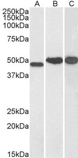 NDRG1 Antibody - Goat Anti-NDRG1 Antibody (0.1µg/ml) staining of Human Kidney (A), Cerebellum (B) and Testis (C) lysate (35µg protein in RIPA buffer). Detected by chemiluminescencence.