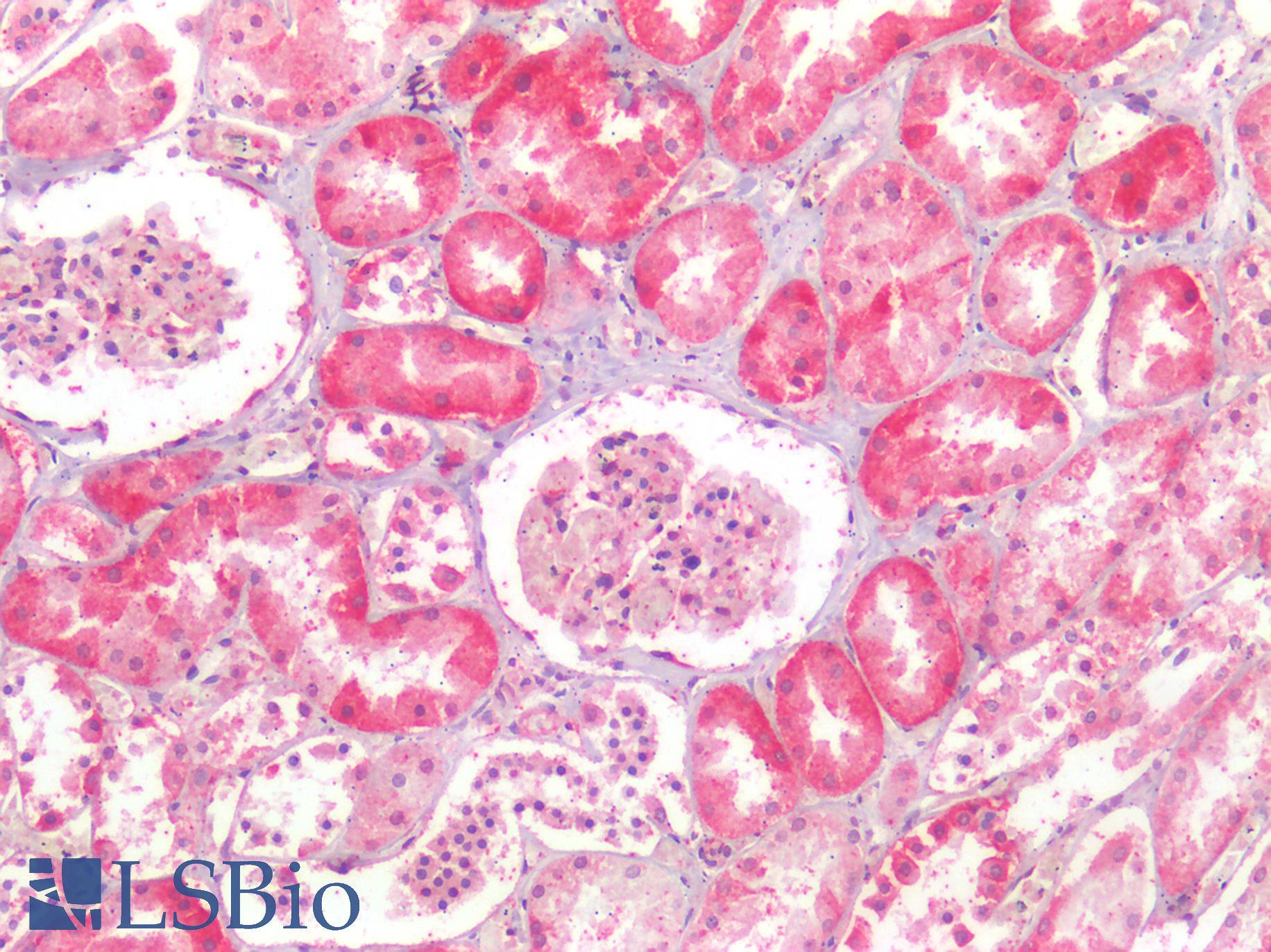 NDRG1 Antibody - Human Kidney: Formalin-Fixed, Paraffin-Embedded (FFPE)