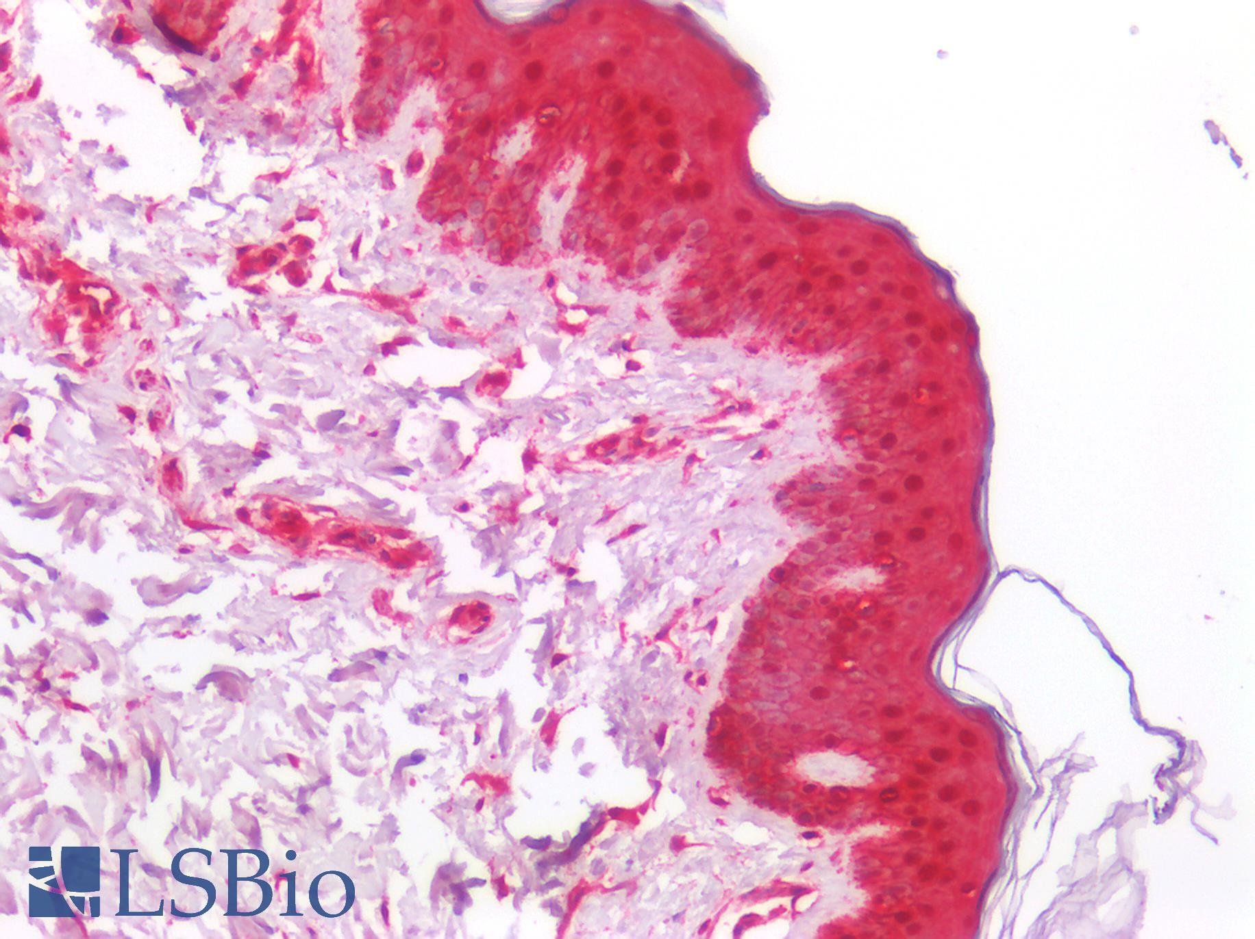 NDRG1 Antibody - Human Skin: Formalin-Fixed, Paraffin-Embedded (FFPE)