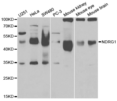 NDRG1 Antibody - Western blot analysis of extracts of various cell lines, using NDRG1 antibody.
