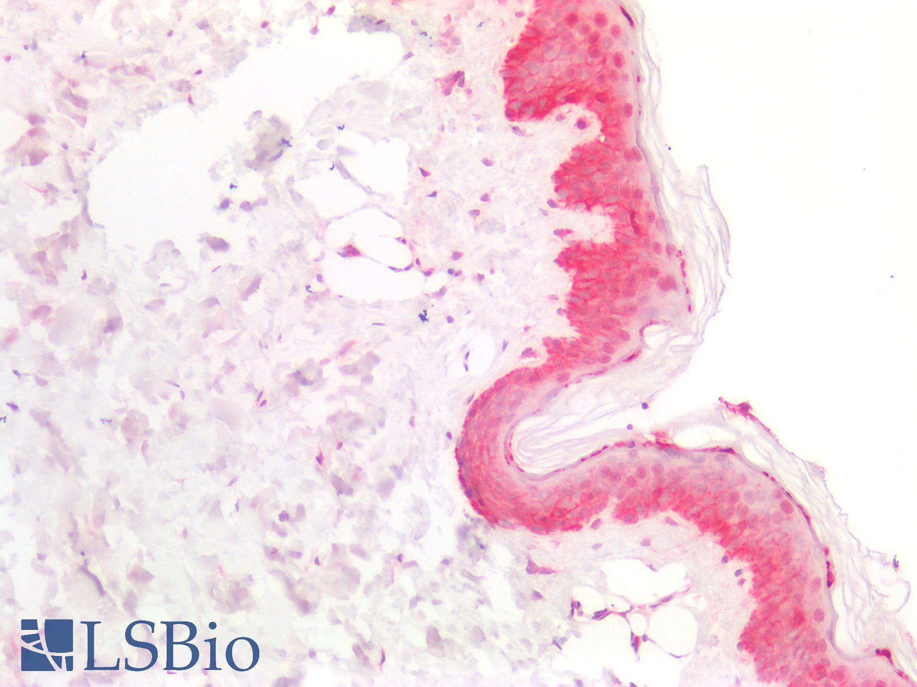 NDRG1 Antibody - Human Skin: Formalin-Fixed, Paraffin-Embedded (FFPE)