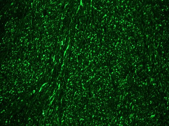 NEFM / NF-M Antibody - Indirect immunofluorescence staining of rat brain tissue section with NEFM / NF-M