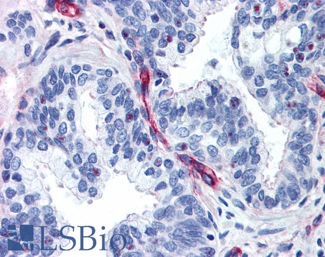 NES / Nestin Antibody - Anti-Nestin antibody IHC of human prostate. Immunohistochemistry of formalin-fixed, paraffin-embedded tissue after heat-induced antigen retrieval. Antibody concentration 5 ug/ml.  This image was taken for the unconjugated form of this product. Other forms have not been tested.