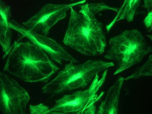 NES / Nestin Antibody - Immunostaining of intracellular nestin filaments in U251 cells