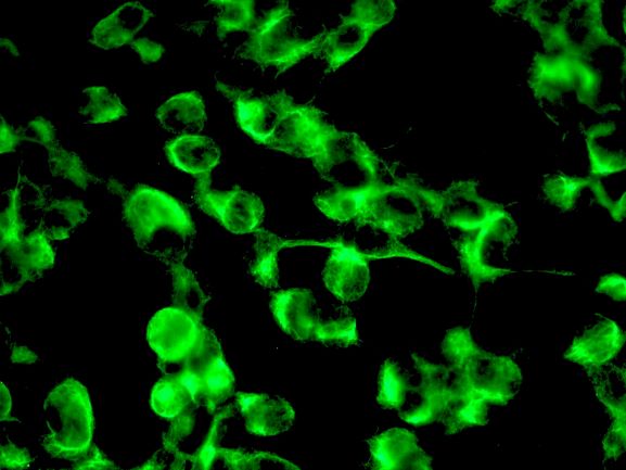 NES / Nestin Antibody - Immunostaining of intracellular nestin filaments in cultured SH-SY-5Y neuronal cells using NES / Nestin (1:100 dilution).
