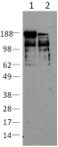 NES / Nestin Antibody - U251 cell lysates prepared under non-reducing (lane 1) or reducing (lane 2) conditions were resolved by SDS-PAGE then immunoblotted with 2 ug/ml of anti-human nestin (10C2) antibody. Bands were visualized using HRP-conjugated anti-mouse IgG.