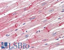 NES / Nestin Antibody - Anti-Nestin antibody IHC of human heart. Immunohistochemistry of formalin-fixed, paraffin-embedded tissue after heat-induced antigen retrieval. Antibody dilution 20 ug/ml.