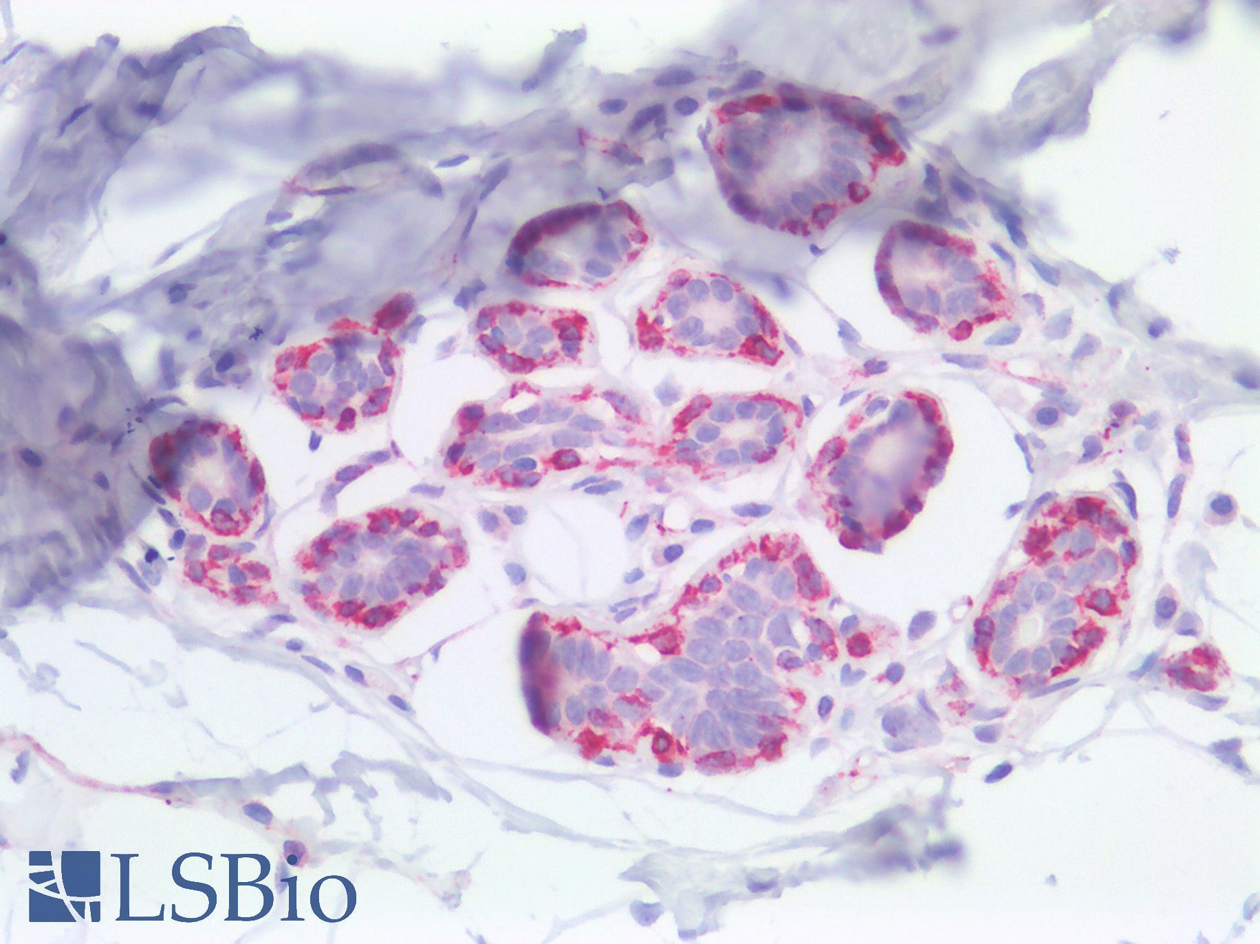 NES / Nestin Antibody - Human Breast: Formalin-Fixed, Paraffin-Embedded (FFPE)