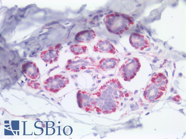 NES / Nestin Antibody - Human Breast: Formalin-Fixed, Paraffin-Embedded (FFPE)