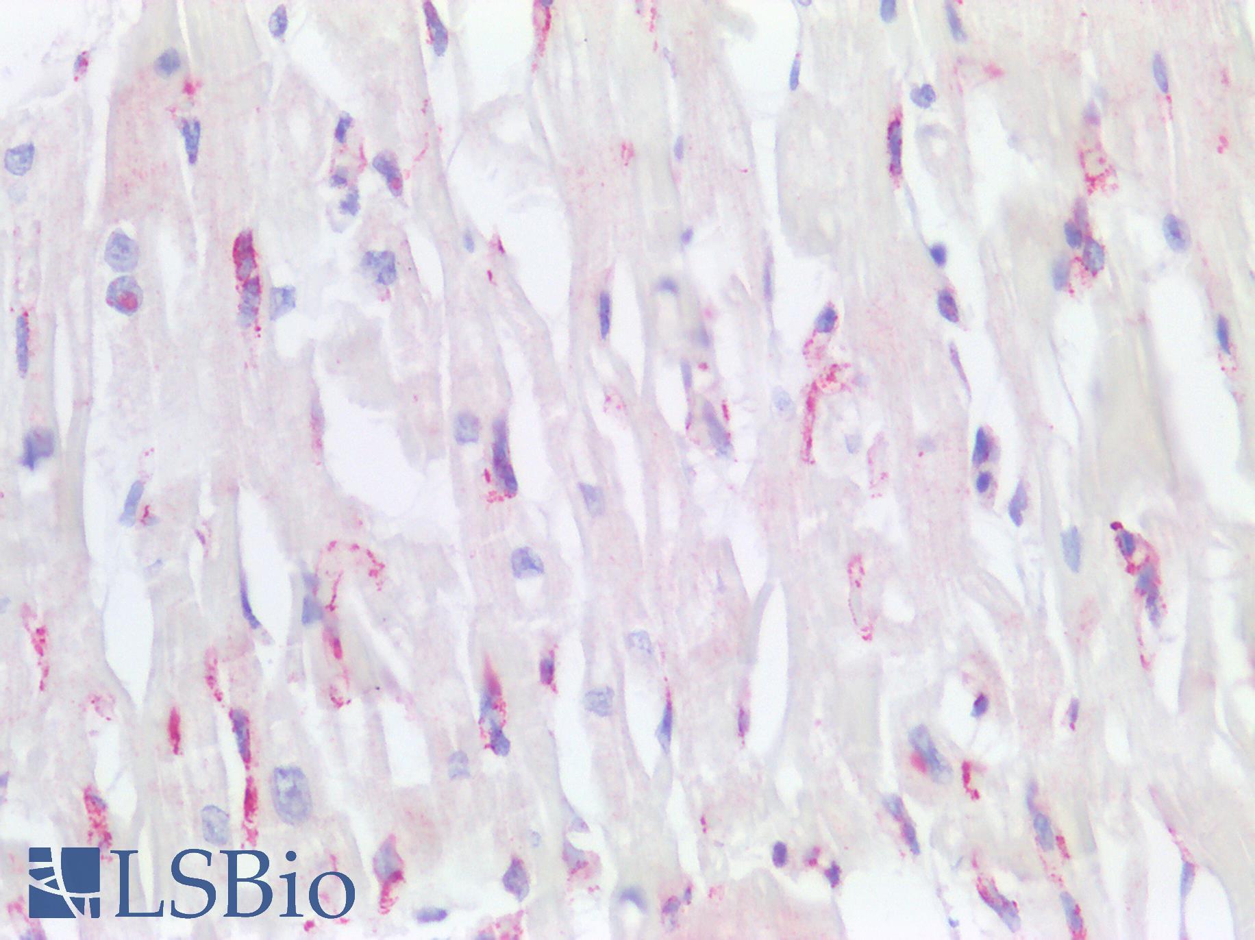NES / Nestin Antibody - Human Heart: Formalin-Fixed, Paraffin-Embedded (FFPE)
