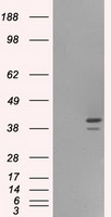 NF45 / ILF2 Antibody - HEK293T cells were transfected with the pCMV6-ENTRY control (Left lane) or pCMV6-ENTRY ILF2 (Right lane) cDNA for 48 hrs and lysed. Equivalent amounts of cell lysates (5 ug per lane) were separated by SDS-PAGE and immunoblotted with anti-ILF2.