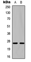 NGF Antibody - Western blot analysis of pro-NGF beta expression in Jurkat (A); NIH3T3 (B) whole cell lysates.