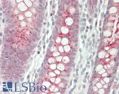 NGF Antibody - Human Colon: Formalin-Fixed, Paraffin-Embedded (FFPE)