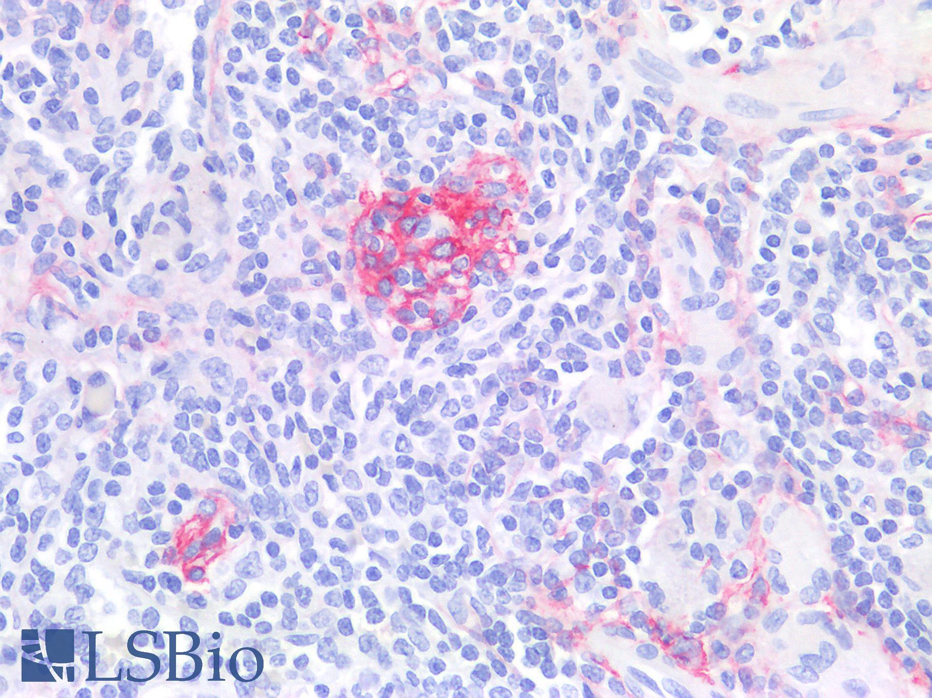 NGFR / CD271 / TNR16 Antibody - Human Spleen: Formalin-Fixed, Paraffin-Embedded (FFPE)