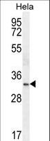 NKX2-1 / Thyroid-Specific TF Antibody - NKX2-1 Antibody western blot of HeLa cell line lysates (35 ug/lane). The NKX2-1 antibody detected the NKX2-1 protein (arrow).