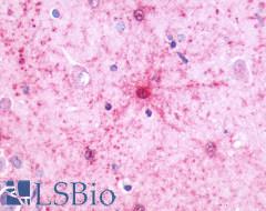 NMBR Antibody - Brain, Astrocytes