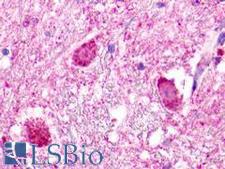 NMUR1 Antibody - Brain, Medulla