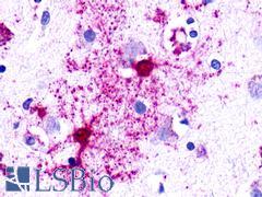 NMUR1 Antibody - Brain, protoplasmic Astrocytes