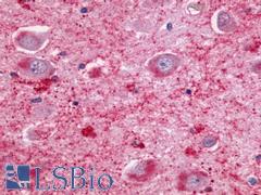 NMUR2 Antibody - Brain, Hippocampus, CA3