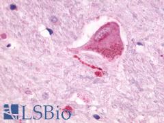 NMUR2 Antibody - Brain, Thalamus, neuron