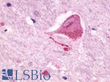 NMUR2 Antibody - Brain, Thalamus, neuron