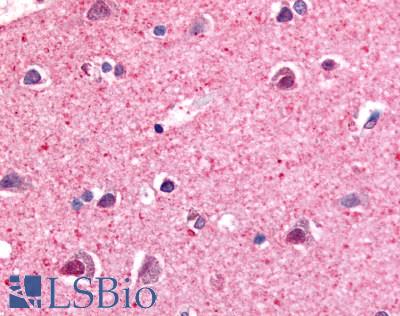 Nor-1 / NR4A3 Antibody - Anti-NR4A3 antibody IHC of human brain, neurons and glia. Immunohistochemistry of formalin-fixed, paraffin-embedded tissue after heat-induced antigen retrieval.