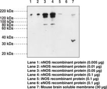 NOS1 / nNOS Antibody - Western blot of NNOS / NOS antibody.
