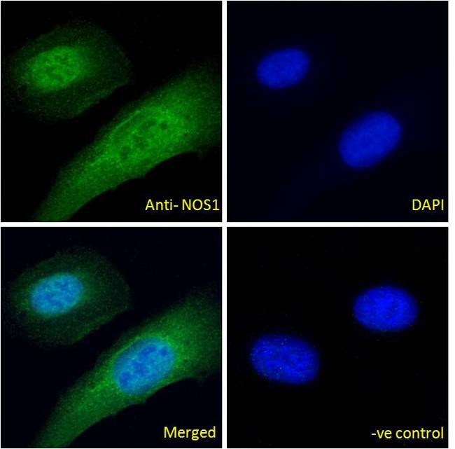 NOS1 / nNOS Antibody - NOS1 Antibody Immunofluorescence analysis of paraformaldehyde fixed U2OS cells, permeabilized with 0.15% Triton. Primary incubation 1hr (10ug/ml) followed by Alexa Fluor 488 secondary antibody (4ug/ml), showing nuclear and Plasma Membrane staining. The nuclear stain is DAPI (blue). Negative control: Unimmunized goat IgG (10ug/ml) followed by Alexa Fluor 488 secondary antibody (4ug/ml).