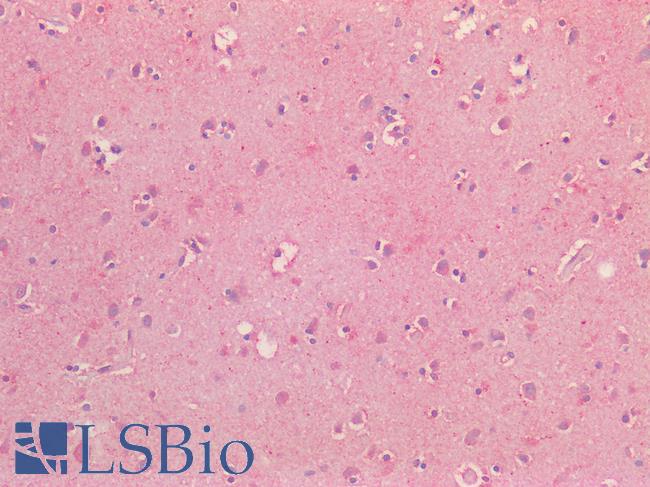 NOS1 / nNOS Antibody - Human Brain, Cortex: Formalin-Fixed, Paraffin-Embedded (FFPE)