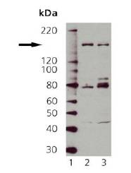 NOS1 / nNOS Antibody - Lane 1: MWM, Lane 2: Rat Brain, Lane 3: Mouse Brain
